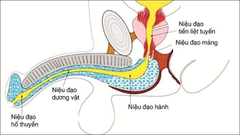 Viêm niệu đạo thường tự khỏi mà không có biến chứng, ngay cả khi không được điều trị