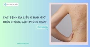 Các bệnh Da Liễu Ở Nam Giới: Triệu Chứng Và Cách Phòng Tránh