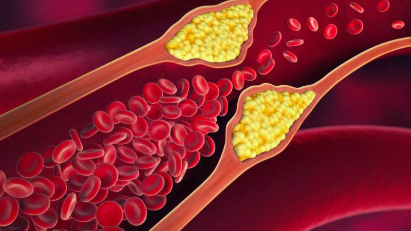 Lá vông có thể làm giảm lượng cholesterol và bảo vệ tim mạch khỏi các bệnh lý