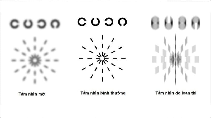 Chẩn đoán loạn thị bằng cách kiểm tra thị lực