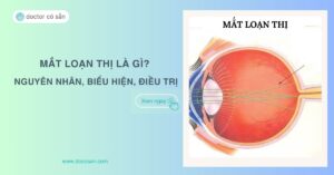 Mắt loạn thị là gì? Nguyên nhân, biểu hiện và cách điều trị