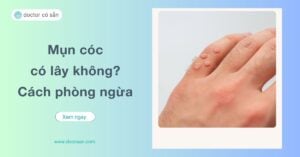 Mụn cóc là một vấn đề da liễu phổ biến, nhưng đến nay nhiều người vẫn thắc mắc rằng "mụn cóc có lây không"?