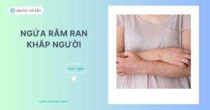 Ngứa râm ran toàn khắp người không nổi mẩn thường khó xác định nguyên nhân