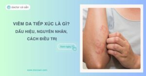 Viêm da tiếp xúc là gì? Dấu hiệu, nguyên nhân và cách điều trị