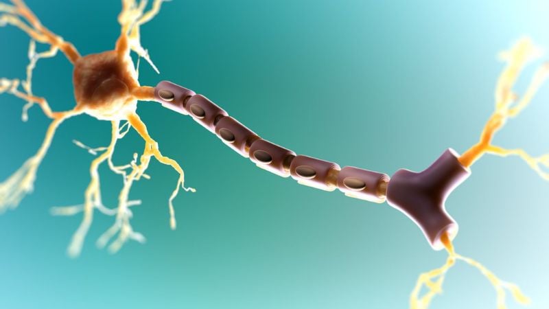 Mất các sợ bao Myelin là nguyên nhân của bệnh đa xơ cứng