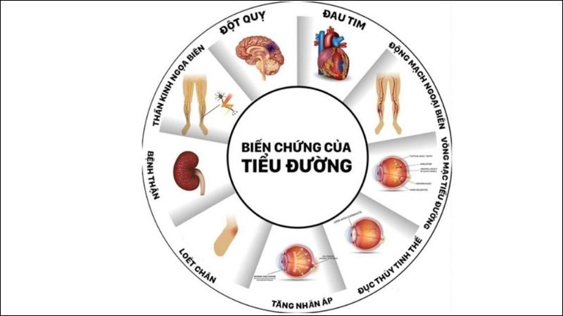 Biến chứng tiểu đường là nguyên nhân chính rút ngắn tuổi thọ của bệnh nhân