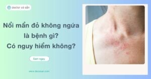 Nổi mẩn đỏ không ngứa là hiện tượng khá phổ biến và có thể xuất hiện do nhiều nguyên nhân khác nhau, từ phản ứng nhẹ của cơ thể đến dấu hiệu của các bệnh lý tiềm ẩn