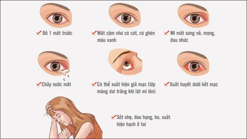 Các triệu chứng điển hình của đau mắt đỏ 