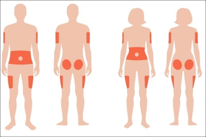 Thay đổi vị trí tiêm thường xuyên giúp hạn chế loạn dưỡng mô mỡ