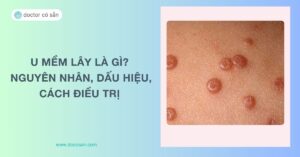 U mềm lây là gì? Nguyên nhân, dấu hiệu, cách điều trị