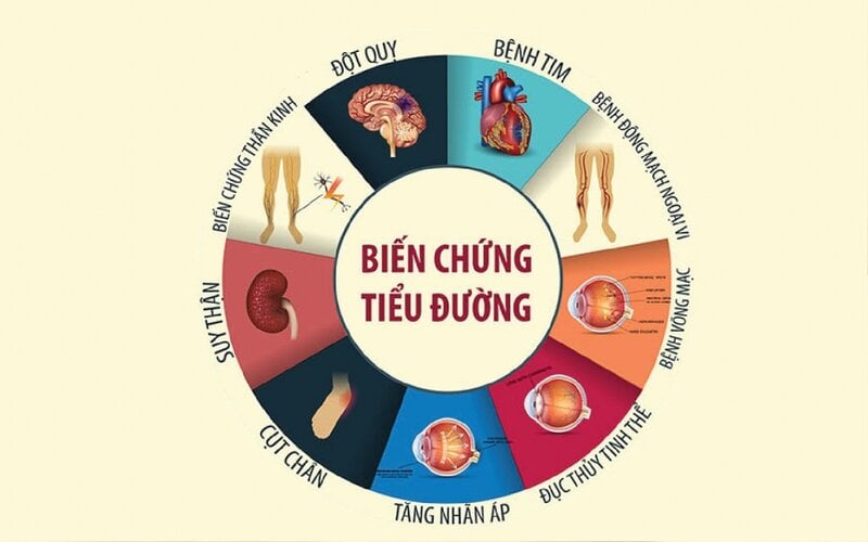 Biến chứng tiểu đường có thể ảnh hưởng đến nhiều cơ quan trong cơ thể, bao gồm mắt, thận, tim, hệ thần kinh và bàn chân