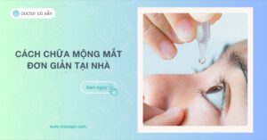 Cách chữa mộng mắt tại nhà Mẹo đơn giản, dễ thực hiện