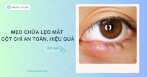 Mẹo chữa lẹo mắt cột chỉ an toàn, hiệu quả ngay tại nhà và các lưu ý