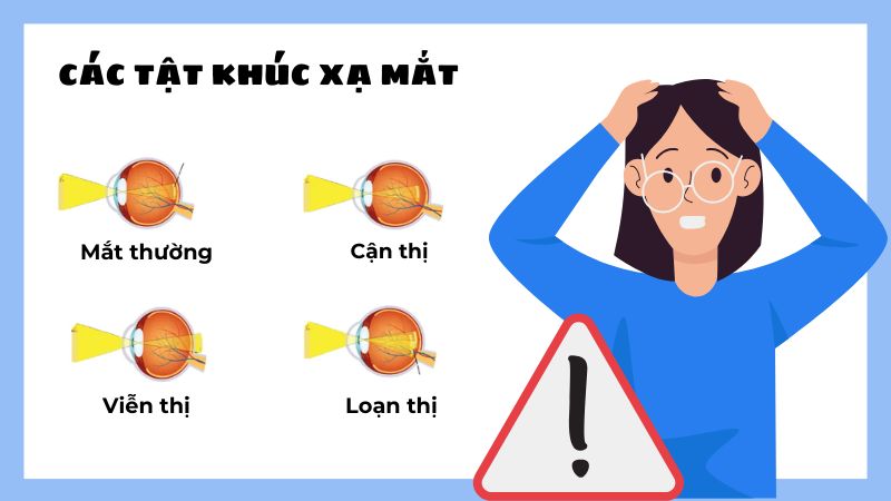 Tật khúc xạ mắt là tình trạng mắt không thể tập trung tia sáng chính xác lên võng mạc, khiến hình ảnh bị mờ.