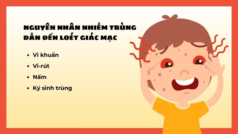 Vi khuẩn, virus, nấm, ký sinh trùng gây nhiễm trùng dẫn đến loét giác mạc ở trẻ