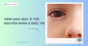 Viêm giác mạc ở trẻ em: Nguyên nhân, triệu chứng và cách điều trị