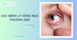 Võng mạc mắt là gì Các bệnh về võng mạc mắt thường gặp