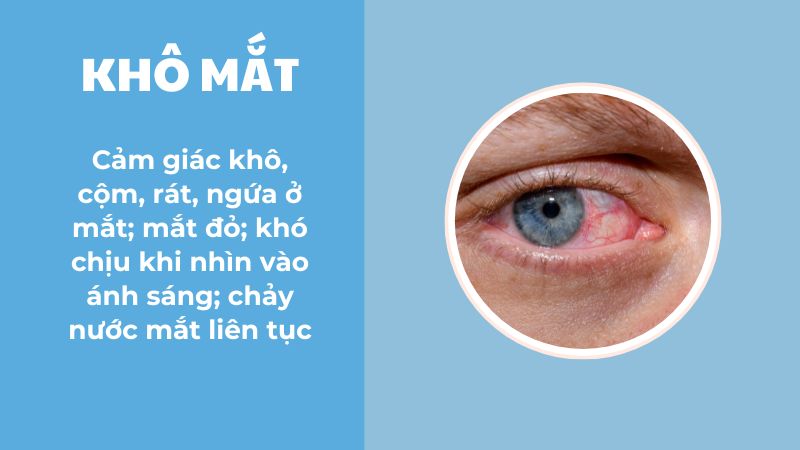 Các vấn đề thị lực thường gặp ở người lớn tuổi - Khô mắt