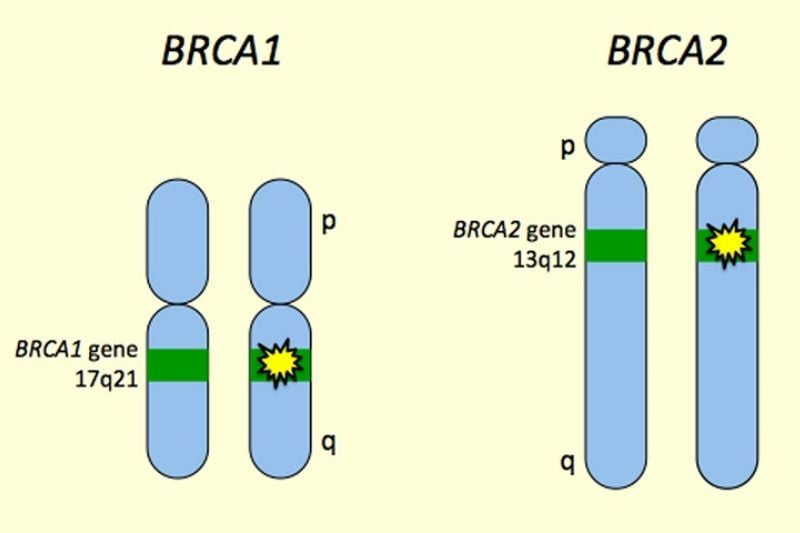 Đột biến tại các gen BRCA1 và BRCA2 làm tăng nguy cơ mắc cả hai loại ung thư