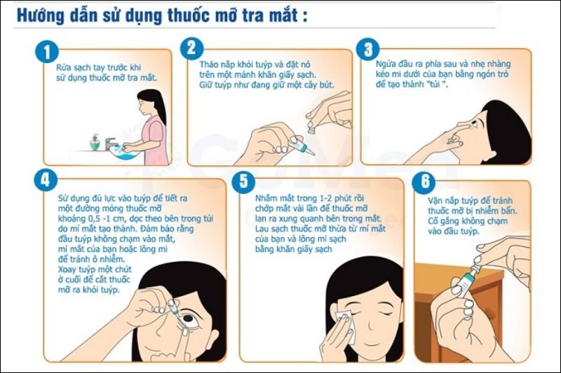 Thứ tự các bước thực hiện tra thuốc mỡ mắt