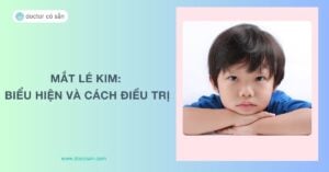 Mắt lé kim: Biểu hiện mắt lé kim ở trẻ em và cách điều trị