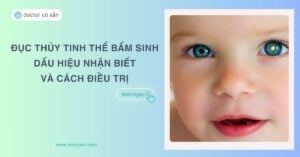 Đục thủy tinh thể bẩm sinh: Dấu hiệu nhận biết và cách điều trị