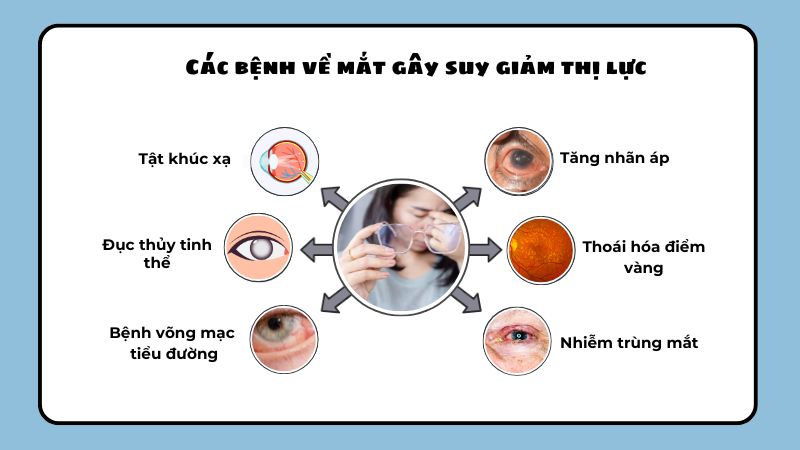 Suy giảm thị lực là gì - Các bệnh về mắt