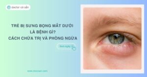 Trẻ bị sưng bọng mắt dưới là bệnh gì? Cách chữa trị và phòng ngừa