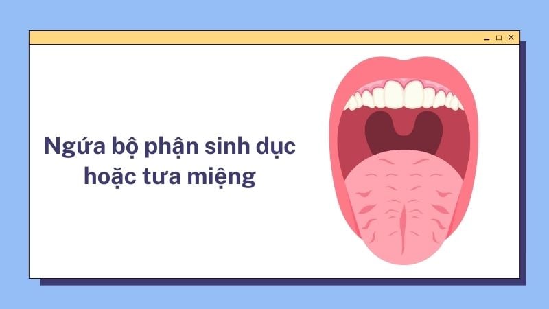 Ngứa bộ phận sinh dục hoặc tưa miệng là dấu hiệu đái tháo đường thai kỳ