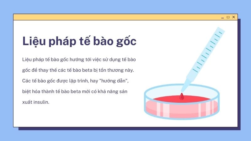 Nghiên cứu mới về đái tháo đường type 1 - Liệu pháp tế bào gốc