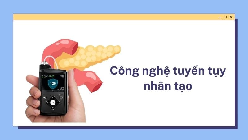 Nghiên cứu công nghệ tuyến tụy nhân tạo đái tháo đường type 1