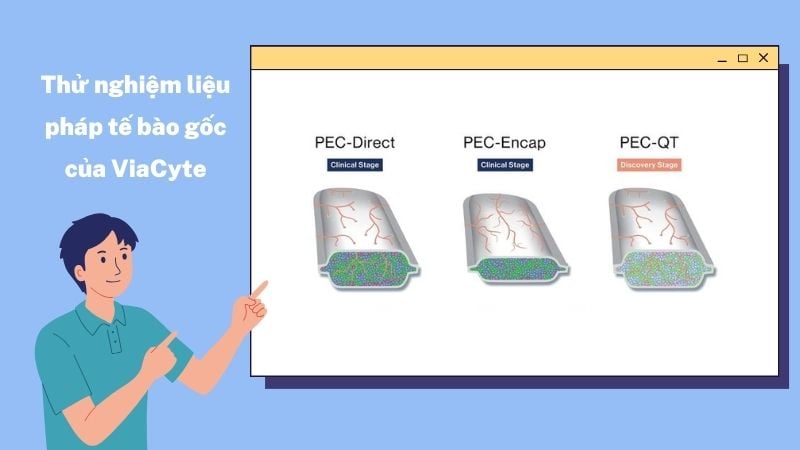 Thử nghiệm liệu pháp tế bào gốc Viacyte